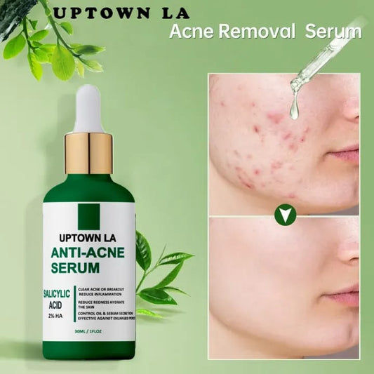 Anti Acne Serum
